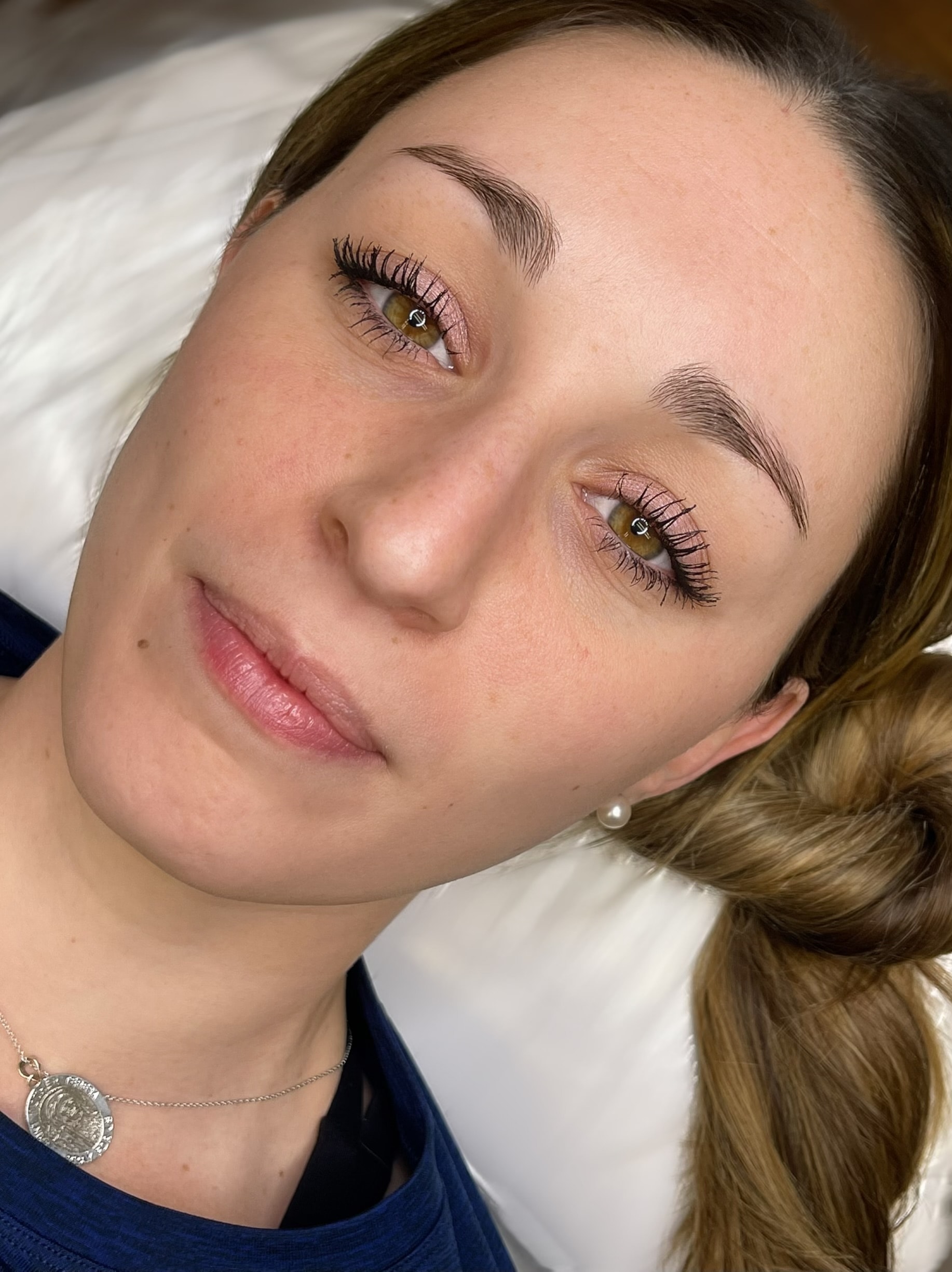 Non-Invasive Facelift — Lower Face